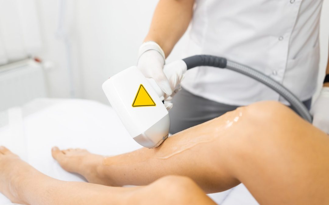 Laser Hair Removal